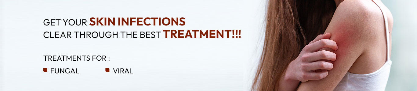 best-skin-allergy-and-skin-infection-treatment-clinic-in-hyderabad