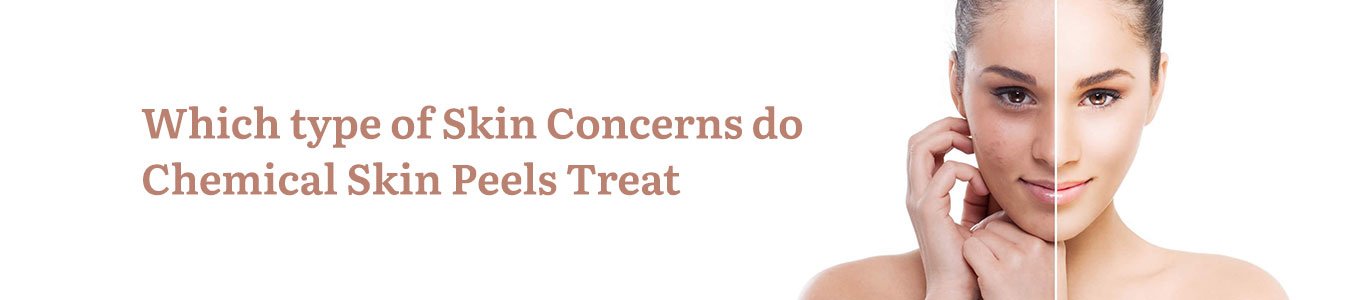 Which type of Skin Concerns do Chemical Skin Peels Treat