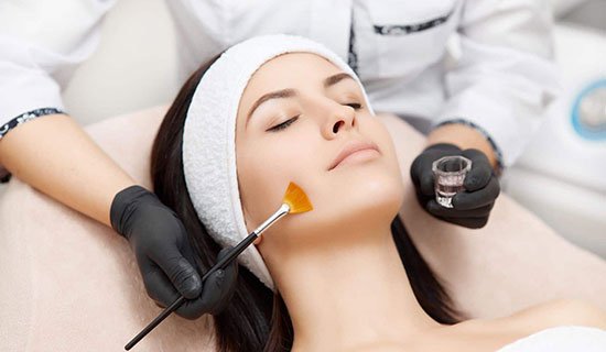 Read more about the article What to Expect from a Chemical Peel