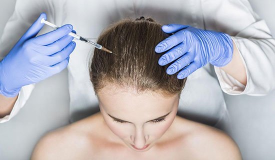 prp-Injections-for-hair-loss-what-you-need-to-know