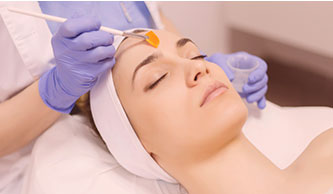 chemical-peel-effective-acne-treatment-in-hyderabad