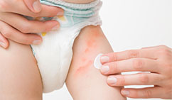 diaper-rash-treatment-at-skinbliss-clinic-in-hyderabad