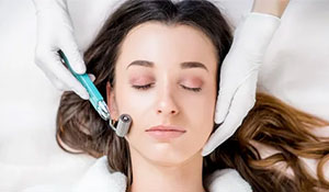 microneedling-is-effective-open-pores-treatment-in-hyderabad