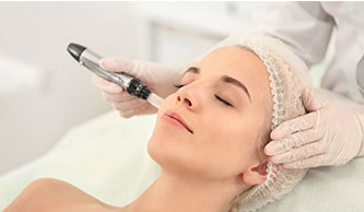 microneedling-treatment-is-effective-acne-&-acne-scars-treatment-in-hyderabad