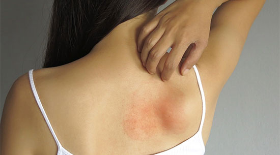 get-best-clinical-dermatology-in-hyderabad