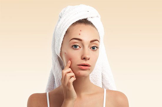 Read more about the article When Is the Right Time to Undergo Treatment for Acne Scars