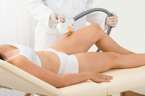 Read more about the article Laser hair removal Hyderbad Is it worth it