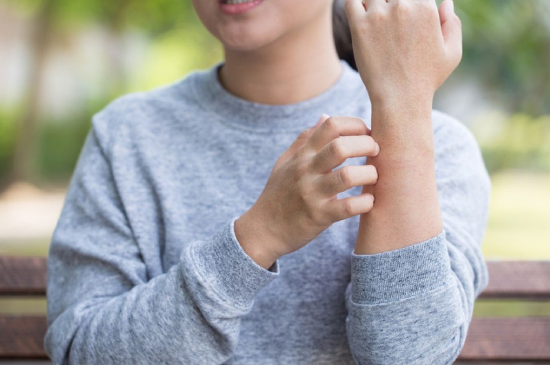 Read more about the article How to Manage Eczema in Winters