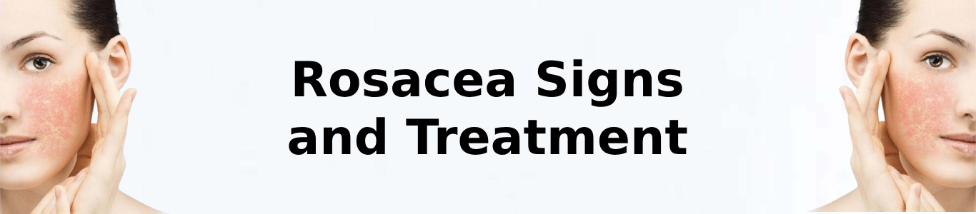 Rosacea Signs and Treatment 