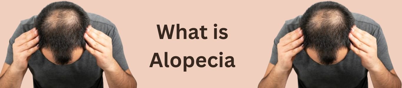 alopecia-treatment-in-skinbliss-clinic