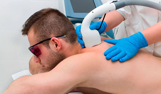 Read more about the article Laser Hair Reduction in Men