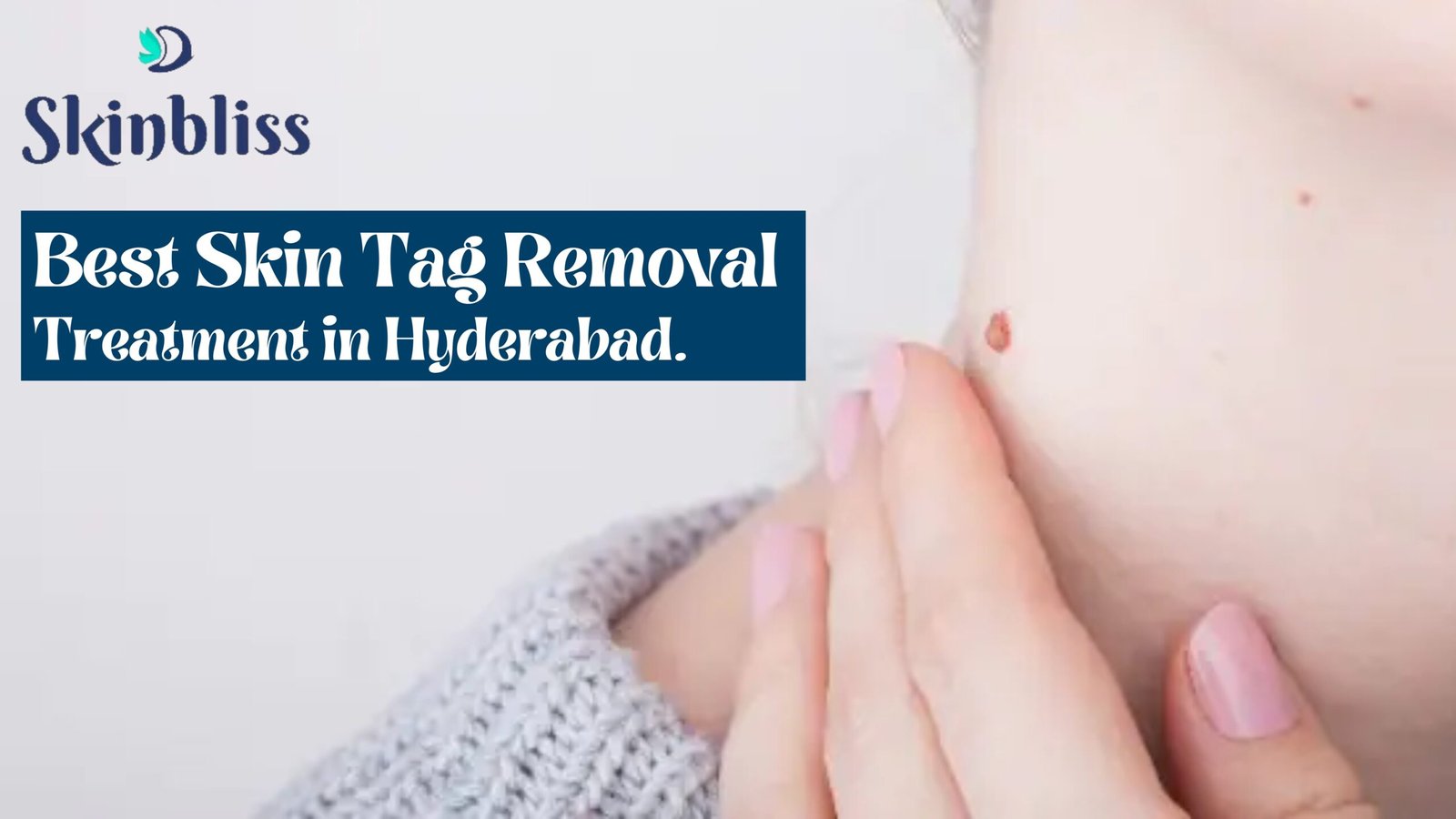 Read more about the article Best Skin Tag Removal Treatment in Hyderabad – Skin Bliss Clinic