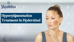 Hyperpigmentation Treatment in Hyderabad