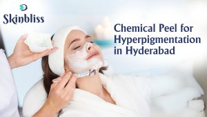 Read more about the article Chemical Peel for Hyperpigmentation in Hyderabad – Skin Bliss Clinic
