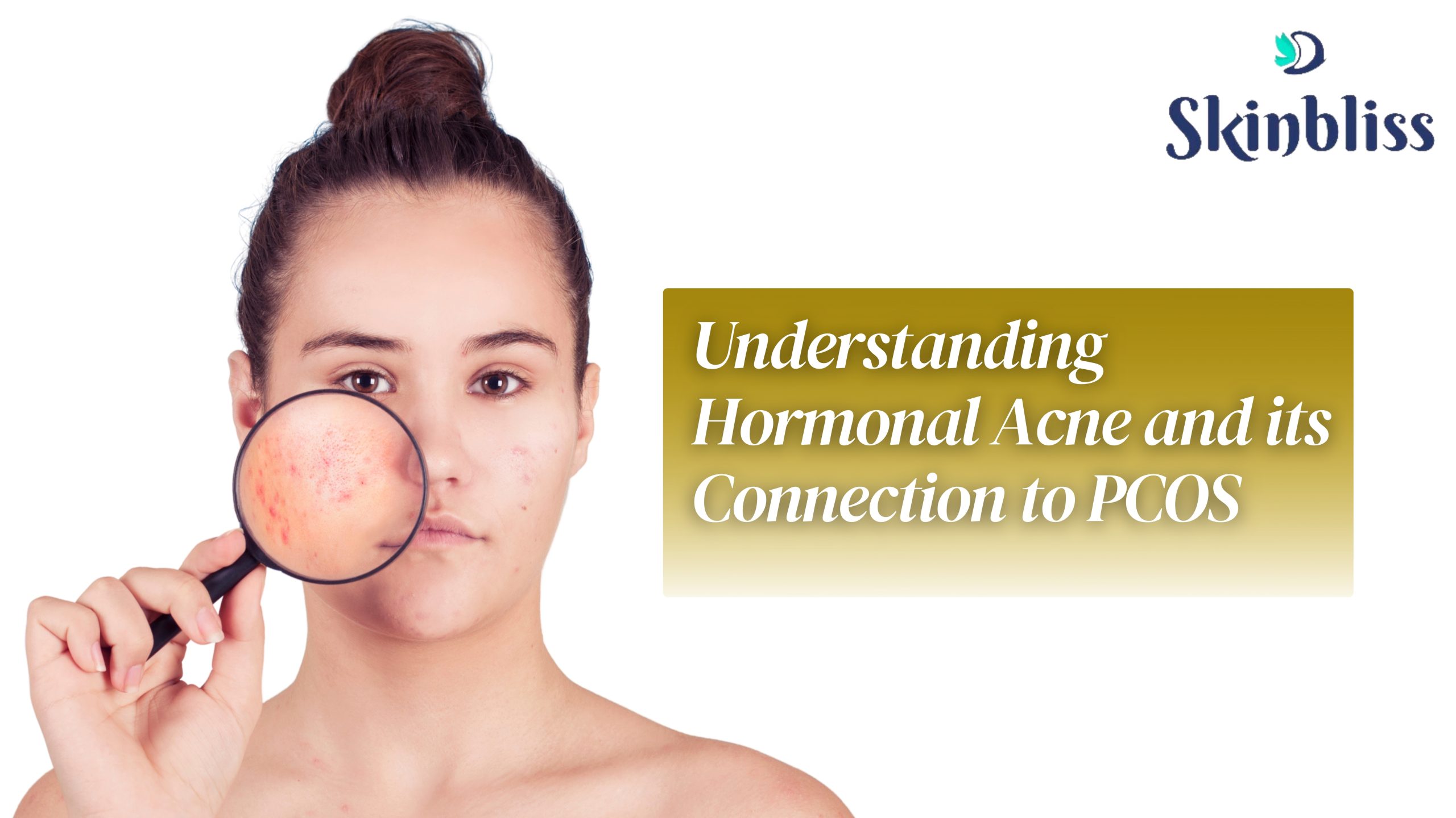 Read more about the article Understanding Hormonal Acne and Its Connection to PCOS – Skin Bliss Clinic
