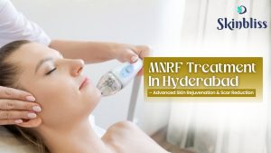 Read more about the article MNRF Treatment in Hyderabad – Advanced Skin Rejuvenation & Scar Reduction – Skin Bliss Clinic