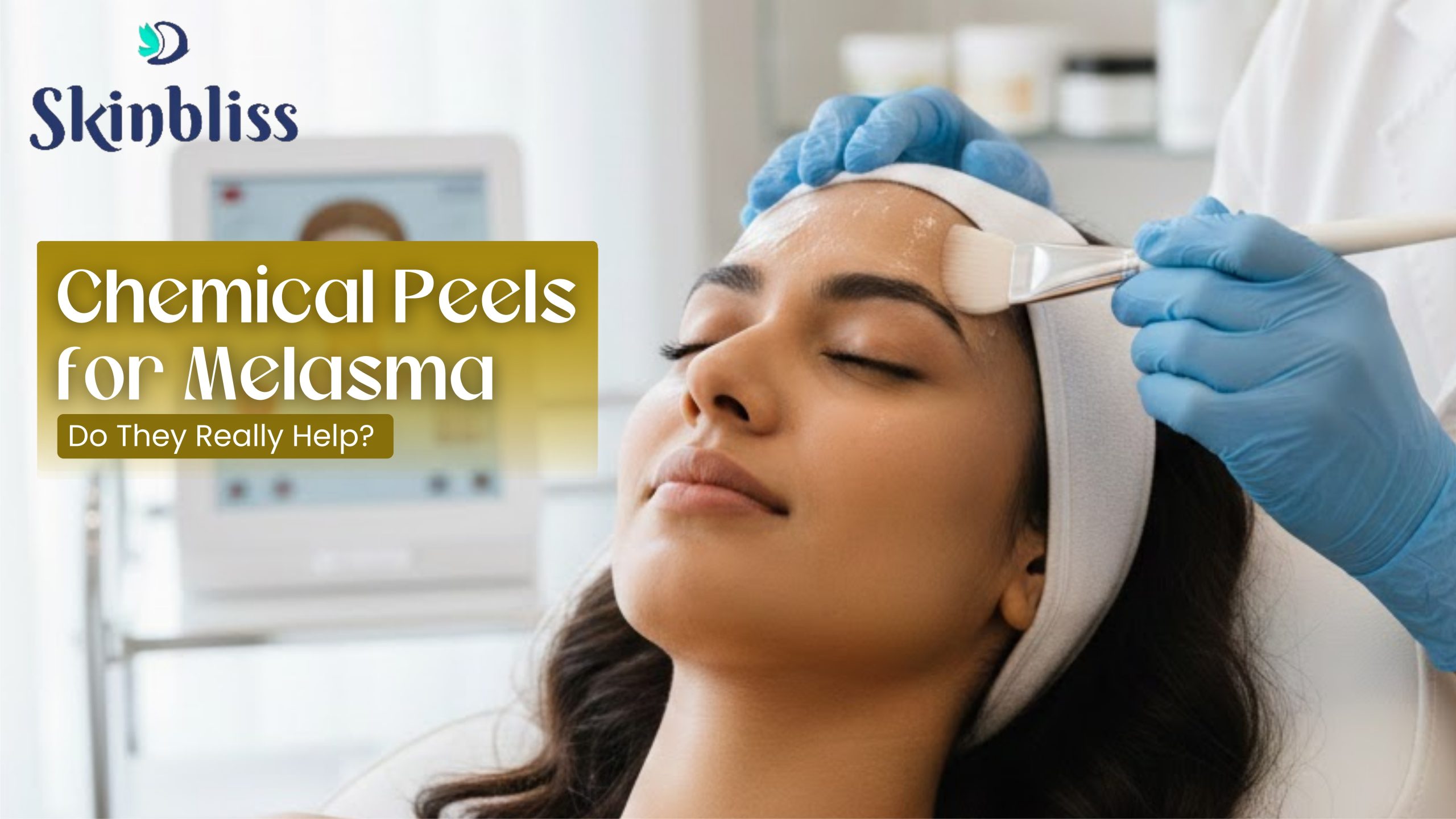 Read more about the article Chemical Peels for Melasma: Do They Really Help? – Skin Bliss Clinic