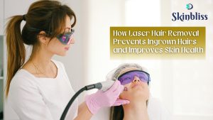 Read more about the article How Laser Hair Removal Prevents Ingrown Hairs and Improves Skin Health – Skin Bliss Clinic, Hyderabad