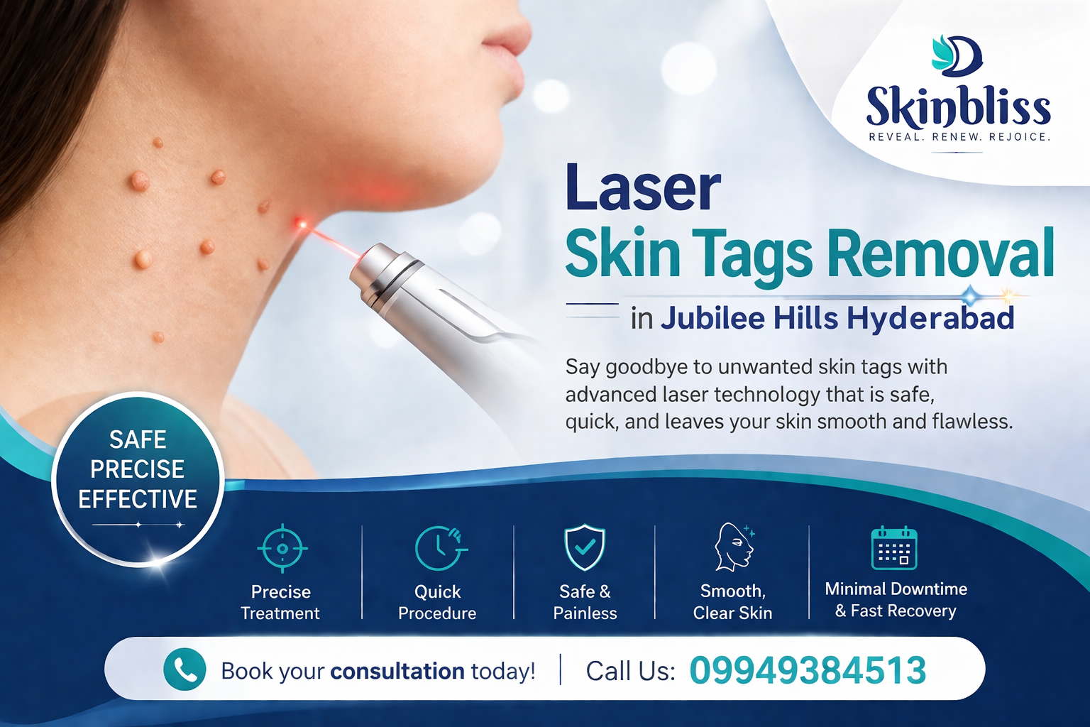Read more about the article Laser Skin Tags Treatment in Jubilee Hills, Hyderabad – Skinbliss