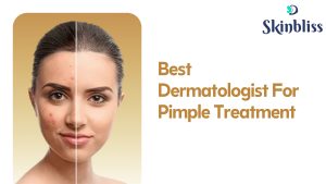Read more about the article Best Dermatologist For Pimple Treatment In Jubilee Hills – Skinbliss (Dr.Deepali)