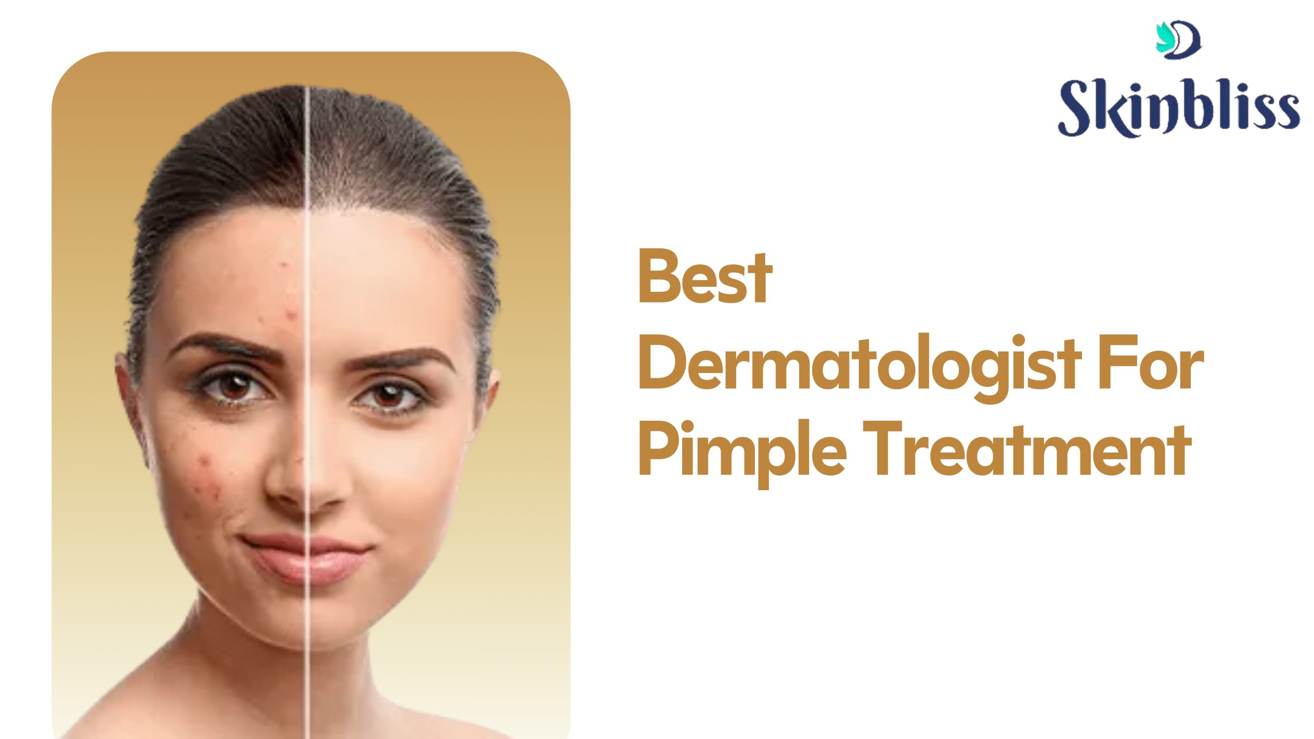 Read more about the article Best Dermatologist For Pimple Treatment In Jubilee Hills – Skinbliss (Dr.Deepali)
