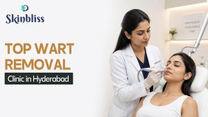 Read more about the article Top Wart Removal Clinic in Hyderabad for Safe & Effective Treatment