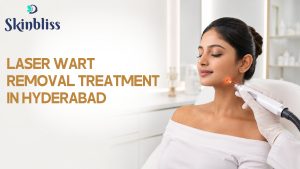 Read more about the article Laser Wart Removal Treatment in Hyderabad – Skin Bliss Clinic