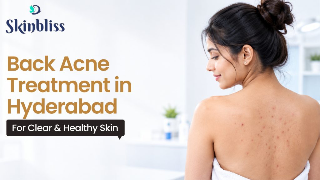 Back Acne Treatment in Hyderabad