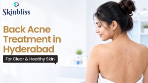 Read more about the article Back Acne Treatment in Hyderabad for Clear & Healthy Skin – Skin Bliss Clinic