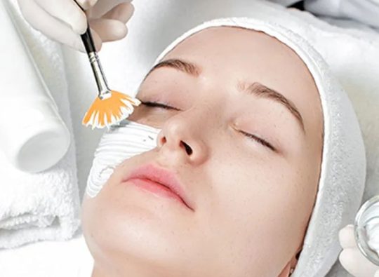 Chemical Peels Treatment in Hyderabad at Skinbliss Clinic