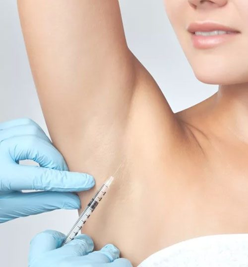 excessive-sweating-treatment-in-hyderabad