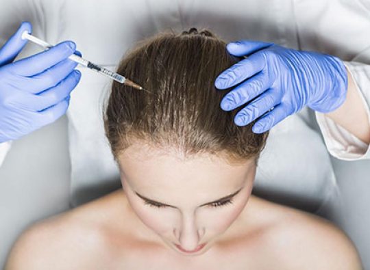 prp-Injections-for-hair-loss-what-you-need-to-know